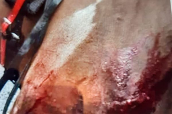 Revulsion at death of  horse in sulky collision